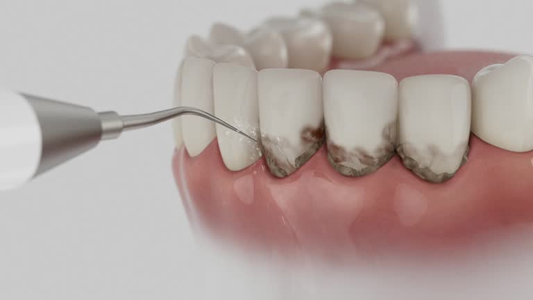 Trusted Dental Implants service in Blue Mountain, MS - Dentist Open Now